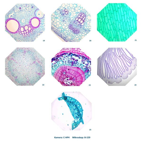 Mikroskop Slayt Seti - Ahşap Kutulu - 25 Slayt